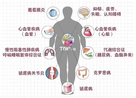 多病|多病共存慢病管理干预？全科医生学术观点获《柳叶刀。